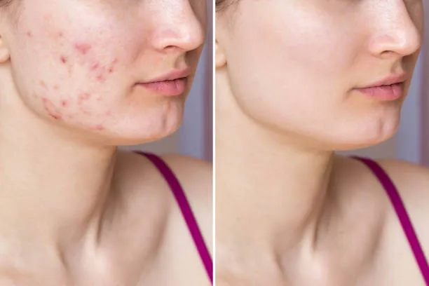 istockphoto-1508860310-612x612-1